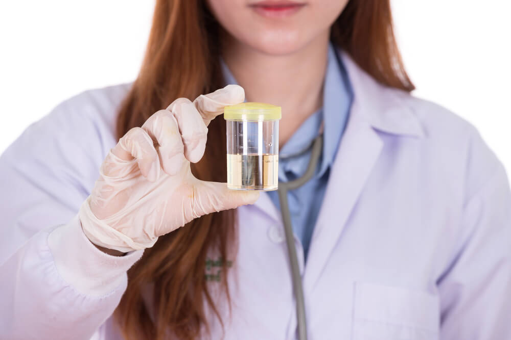 a doctor holds a urine sample destined for drug testing